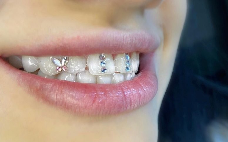 Biżuteria na zęby - sprawdź na czym polega nowy trend / instagram.com/fairy_gemz_